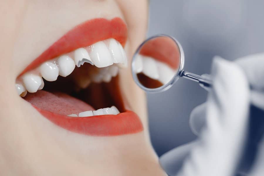 How Much Does It Cost To Fix A Chipped Tooth In India